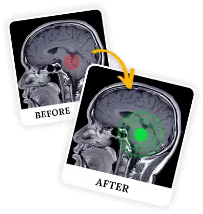 the-brain-song-program